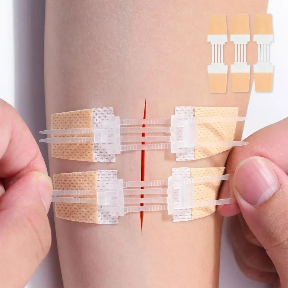 3pcs/set Band-Aid Zipper Tie Wound Closure Patch Hemostatic Patch Wound Fast Suture Zipper Band-Aid Outdoor Emergency Device