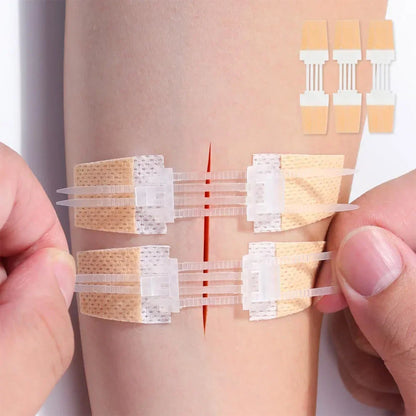 3pcs/set Band-Aid Zipper Tie Wound Closure Patch Hemostatic Patch Wound Fast Suture Zipper Band-Aid Outdoor Emergency Device