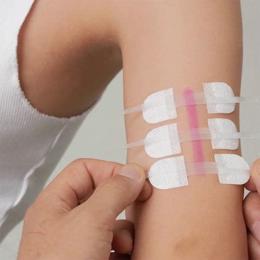 3pcs/set Band-Aid Zipper Tie Wound Closure Patch Hemostatic Patch Wound Fast Suture Zipper Band-Aid Outdoor Emergency Device