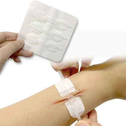 3pcs/set Band-Aid Zipper Tie Wound Closure Patch Hemostatic Patch Wound Fast Suture Zipper Band-Aid Outdoor Emergency Device