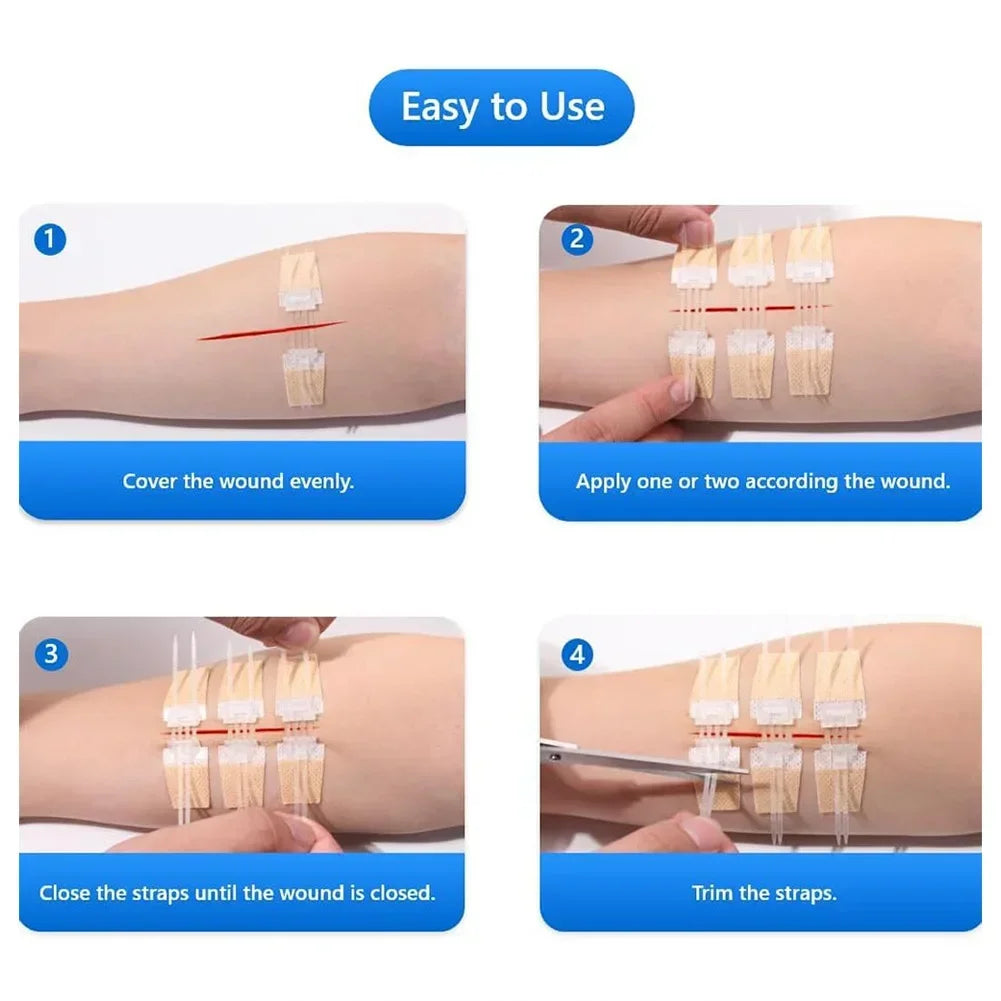 3pcs/set Band-Aid Zipper Tie Wound Closure Patch Hemostatic Patch Wound Fast Suture Zipper Band-Aid Outdoor Emergency Device