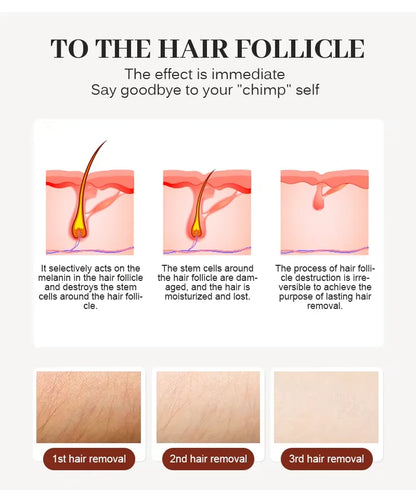 Diode Laser Hair Removal Professional Machine painless cooling permanent lazer hair removal 4 Wavelengths 755 808 940 1064
